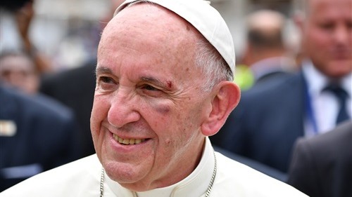 إصابة البابا فرنسيس خلال زيارته بكولومبيا